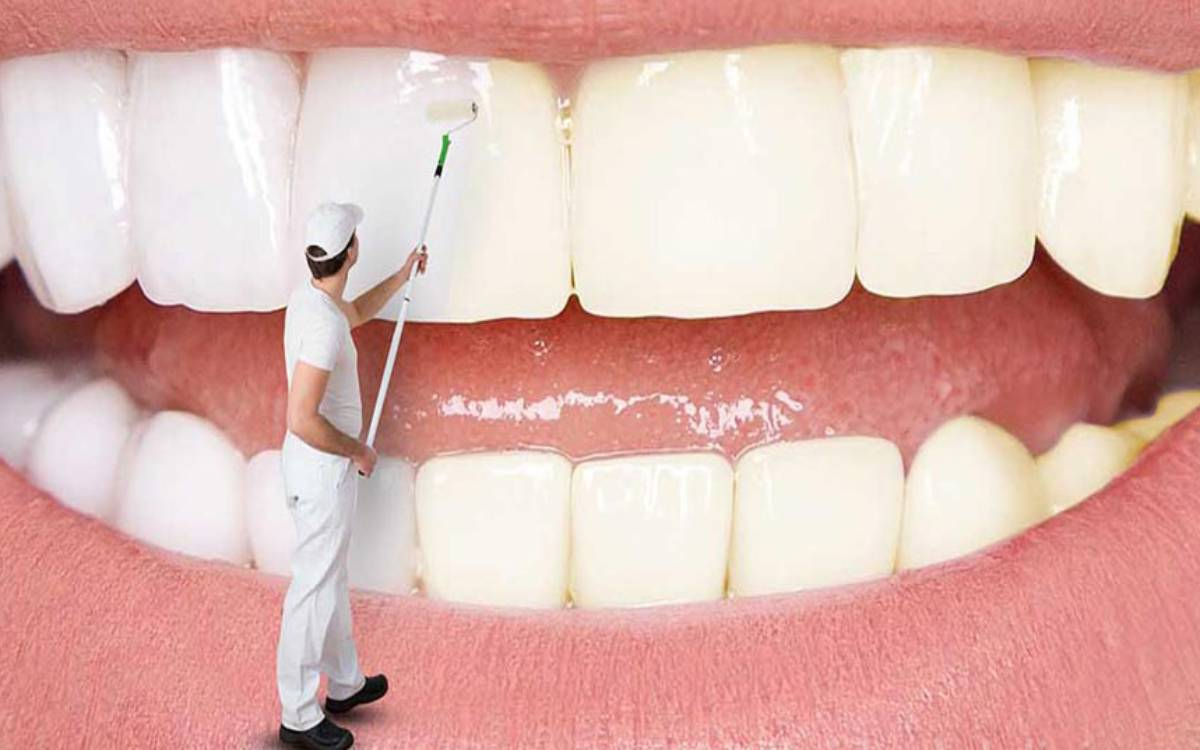 روش های خانگی برای سفید کردن دندان ها